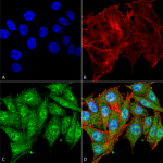 SPC-699_IGF-1_Antibody_ICC-IF_Human_Colon-carcinoma-cell-line-RKO_60X_Composite_1.png