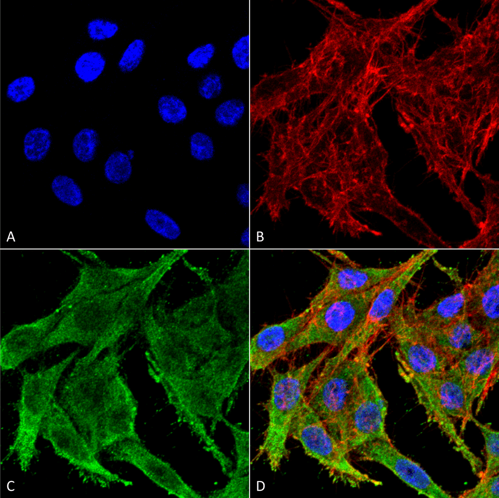 <p>Immunocytochemistry/Immunofluorescence analysis using Rabbit Anti-Kir4.1 Polyclonal Antibody (SPC-700). Tissue: Colon carcinoma cell line (RKO). Species: Human. Fixation: 4% Formaldehyde for 15 min at RT. Primary Antibody: Rabbit Anti-Kir4.1 Polyclonal Antibody (SPC-700) at 1:100 for 60 min at RT. Secondary Antibody: Goat Anti-Rabbit ATTO 488 at 1:100 for 60 min at RT. Counterstain: Phalloidin Texas Red F-Actin stain; DAPI (blue) nuclear stain at 1:1000, 1:5000 for 60 min at RT, 5 min at RT. Localization: Membrane, Cytoplasm. Magnification: 60X. (A) DAPI nuclear stain. (B) Phalloidin Texas Red F-Actin stain. (C) Kir4.1 Antibody. (D) Composite.</p>
