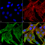 SPC-700_Kir41_Antibody_ICC-IF_Human_Colon-carcinoma-cell-line-RKO_60X_Composite_1.png