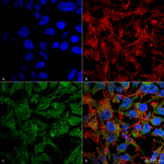 SPC-703-BDNF-Antibody-ICC-IF-Human-Neuroblastoma-cell-line-SK-N-BE-60X-Composite-1.png