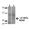 Rabbit Anti-BDNF Antibody used in Western blot (WB) on HeLa and HEK293T cell lysates (SPC-703)