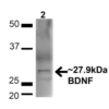 Rabbit Anti-BDNF Antibody used in Western blot (WB) on Brain (SPC-703)