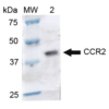 Rabbit Anti-CCR2 Antibody used in Western blot (WB) on Brain cell lysates (SPC-704)
