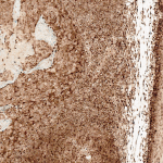 SPC-704_CCR2_Antibody_IHC_Human_Tonsil_10X_1.png