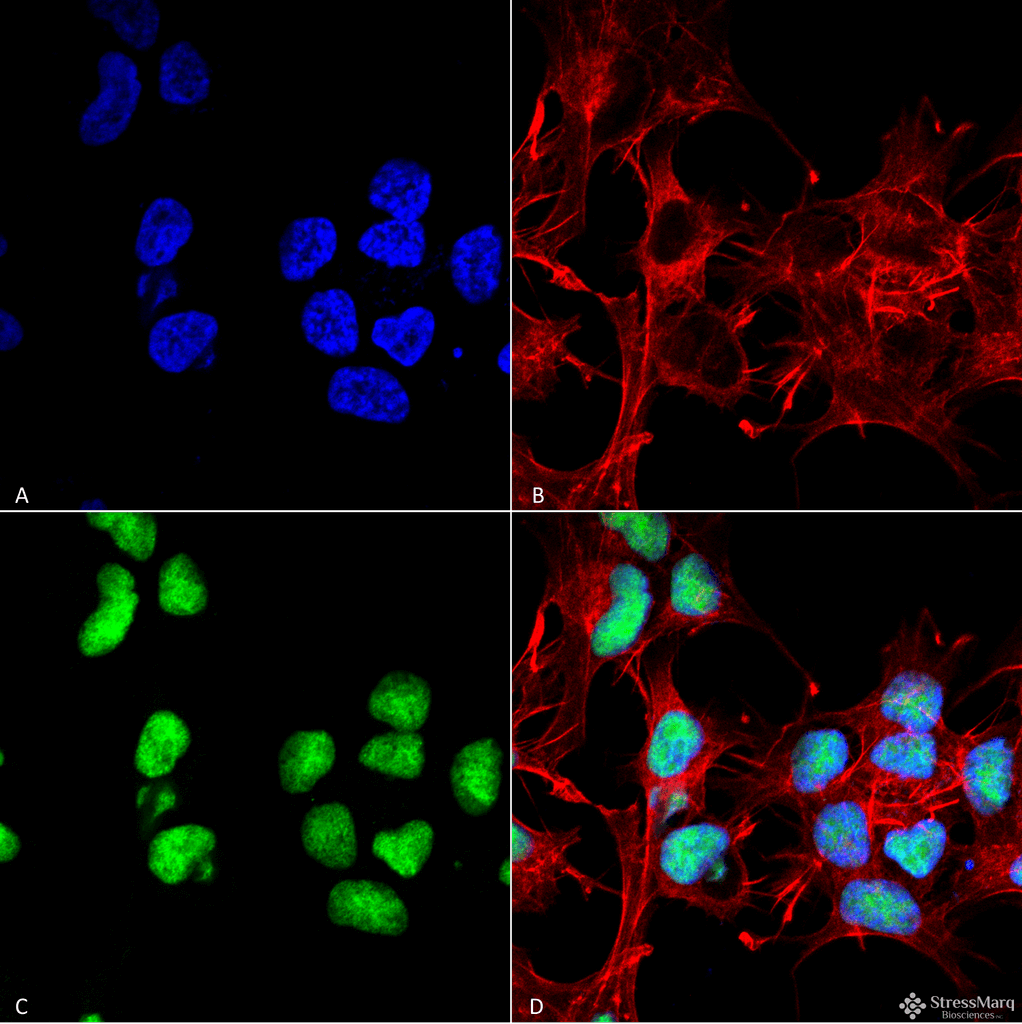 <p>Immunocytochemistry/Immunofluorescence analysis using Rabbit Anti-Choline Acetyltransferase Polyclonal Antibody (SPC-706). Tissue: Neuroblastoma cell line (SK-N-BE). Species: Human. Fixation: 4% Formaldehyde for 15 min at RT. Primary Antibody: Rabbit Anti-Choline Acetyltransferase Polyclonal Antibody (SPC-706) at 1:100 for 60 min at RT. Secondary Antibody: Goat Anti-Rabbit ATTO 488 at 1:100 for 60 min at RT. Counterstain: Phalloidin Texas Red F-Actin stain; DAPI (blue) nuclear stain at 1:1000, 1:5000 for 60min RT, 5min RT. Localization: Nucleus. Magnification: 60X. (A) DAPI (blue) nuclear stain (B) Phalloidin Texas Red F-Actin stain (C) Choline Acetyltransferase Antibody (D) Composite.</p>
