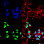 SPC-706-Choline-Acetyltransferase-Antibody-ICC-IF-Human-Neuroblastoma-cell-line-SK-N-BE-60X-Composite-1.png