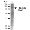 Rabbit Anti-Choline Acetyltransferase Antibody used in Western blot (WB) on Brain (SPC-706)