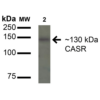 Rabbit Anti-Calcium Sensing Receptor Antibody used in Western blot (WB) on HeLa cell lysates (SPC-713)