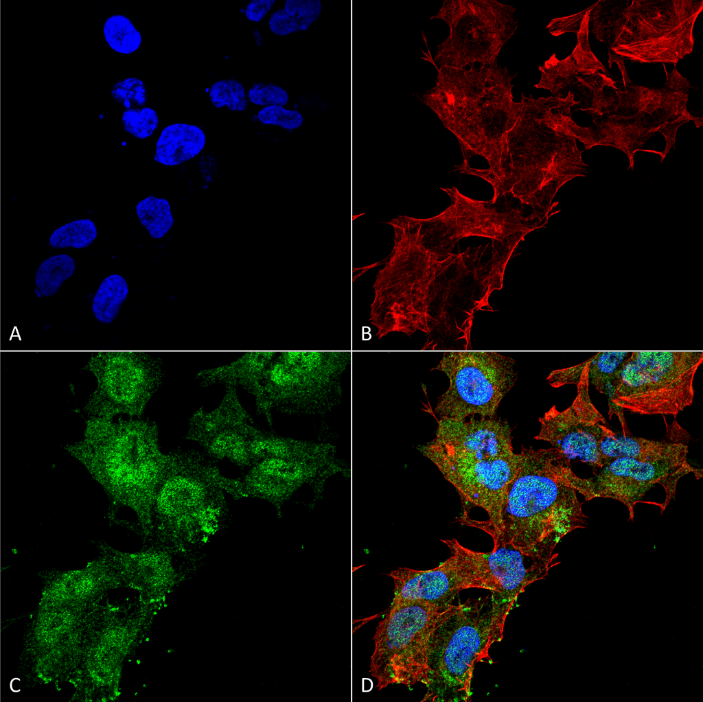 <p>Immunocytochemistry/Immunofluorescence analysis using Rabbit Anti-Calcium Sensing Receptor Polyclonal Antibody (SPC-713). Tissue: Neuroblastoma cell line (SK-N-BE). Species: Human. Fixation: 4% Formaldehyde for 15 min at RT. Primary Antibody: Rabbit Anti-Calcium Sensing Receptor Polyclonal Antibody (SPC-713) at 1:100 for 60 min at RT. Secondary Antibody: Goat Anti-Rabbit ATTO 488 at 1:200 for 60 min at RT. Counterstain: Phalloidin Texas Red F-Actin stain; DAPI (blue) nuclear stain at 1:1000, 1:5000 for 60 min at RT, 5 min at RT. Localization: Cell Membrane, Multi-Pass Membrane Protein. Magnification: 60X. (A) DAPI (blue) nuclear stain (B) Phalloidin Texas Red F-Actin stain (C) Calcium Sensing Receptor Antibody (D) Composite.</p>

