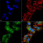 SPC-713_Calcium-Sensing-Receptor_Antibody_ICC-IF_Human_SK-N-BE-Cells-Human-Neuroblastoma-cells_60X_Composite_1.png