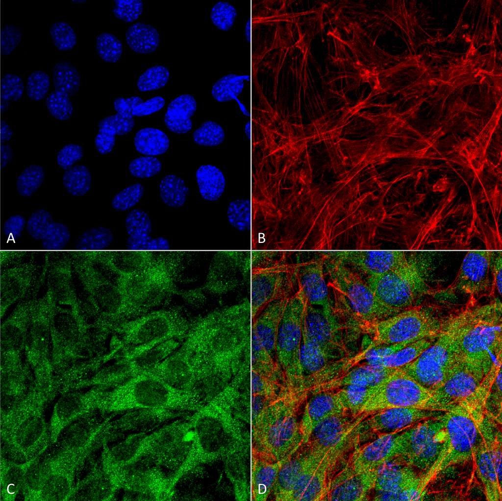 <p>Immunocytochemistry/Immunofluorescence analysis using Rabbit Anti-FNIP1 Polyclonal Antibody (SPC-718). Tissue: C2C12 Cells (Mouse Myoblast cell line). Species: Mouse. Fixation: 4% Formaldehyde for 15 min at RT. Primary Antibody: Rabbit Anti-FNIP1 Polyclonal Antibody (SPC-718) at 1:100 for 60 min at RT. Secondary Antibody: Goat Anti-Rabbit ATTO 488 at 1:200 for 60 min at RT. Counterstain: Phalloidin Texas Red F-Actin stain; DAPI (blue) nuclear stain at 1:1000, 1:5000 for 60 min at RT, 5 min at RT. Localization: Cytoplasm . Magnification: 60X. (A) DAPI (blue) nuclear stain (B) Phalloidin Texas Red F-Actin stain (C) FNIP1 Antibody (D) Composite.</p>
