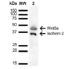 Rabbit Anti-Wnt5a Antibody used in Western blot (WB) on Cervical cancer cell line (HeLa) lysate (SPC-737)