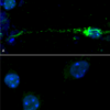 ICC of alpha synuclein phospho serine 129 antibody in primary mouse neurons treated with mouse alpha synuclein PFFs