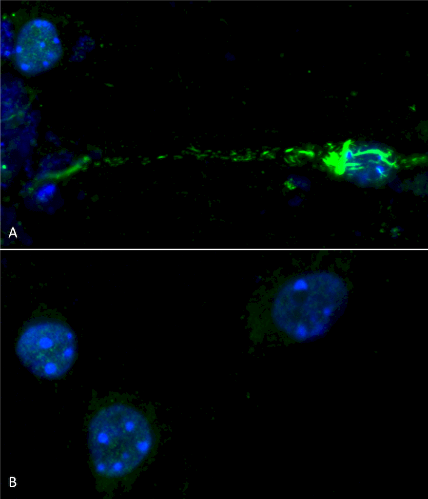 <p>Immunocytochemistry/Immunofluorescence analysis using Rabbit Anti-Alpha Synuclein (pSer129) Polyclonal Antibody (SPC-742). Species: Mouse. Primary Antibody: Rabbit Anti-Alpha Synuclein (pSer129) Polyclonal Antibody (SPC-742). Phospho serine 129 antibody (SPC-742) was used to detect phosphorylated alpha synuclein in primary mouse hippocampal neurons treated with 100 nM sonicated mouse alpha synuclein PFFs (SPR-324) (A).  Phosphorylated alpha synuclein was visible in perinucleus and neurites compared to untreated control (B). Read the protocol at pabmabs.com/?p=7901. Image courtesy of Trine Rasmussen, Simon Molgaard Jensen at Aarhus University..</p>

