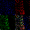 Rabbit Anti-Alpha Synuclein Antibody (pSer129) used in Immunocytochemistry/Immunofluorescence (ICC/IF) on Primary hippocampal neurons treated with active Alpha Synuclein Protein Aggregate (SPR-322) at 4 µg/ml to induce fibrils (SPC-742)