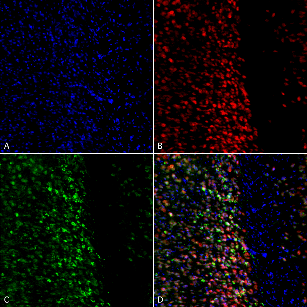 <p>Immunocytochemistry/Immunofluorescence analysis using Rabbit Anti-Alpha Synuclein pSer129 Polyclonal Antibody (SPC-742). Tissue: Primary hippocampal neurons treated with active Alpha Synuclein Protein Aggregate (SPR-322) at 4 µg/ml to induce fibrils. Species: Rat. Fixation: 4% paraformaldehyde. Primary Antibody: Rabbit Anti-Alpha Synuclein pSer129 Polyclonal Antibody (SPC-742) at 1:500 for 24 hours at 4°C. Secondary Antibody: Goat Anti-Rabbit Alexa Fluor 488 at 1:700 for 1 hour at RT. Counterstain: Guinea Pig Anti-NeuN (red) neuronal marker (Donkey Anti-Guinea Pig Alexa Fluor 647 1:700); Hoechst (blue) nuclear stain at 1:6000, 1:3000 for 60 min at RT, 5 min at RT. Magnification: 20X.</p>
