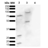 Rabbit Anti-Alpha Synuclein Antibody (pSer129) used in Western blot (WB) on brain lysate (SPC-742)