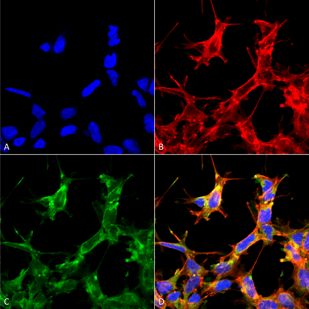<p>Immunocytochemistry/Immunofluorescence analysis using Rabbit Anti-HSP70 Acetyl Lys77 Polyclonal Antibody (SPC-743). Tissue: Embryonic kidney cells (HEK293) cultured overnight with 50 µM H2O2. Species: Human. Fixation: 5% Formaldehyde for 5 min. Primary Antibody: Rabbit Anti-HSP70 Acetyl Lys77 Polyclonal Antibody (SPC-743) at 1:60 for 30-60 min at RT. Secondary Antibody: Goat Anti-Rabbit Alexa Fluor 488 at 1:1500 for 30-60 min at RT. Counterstain: Phalloidin Alexa Fluor 633 F-Actin stain; DAPI (blue) nuclear stain at 1:250, 1:50000 for 30-60 min at RT. Localization: Cytoplasmic. Magnification: 20X (2X Zoom). (A) DAPI (blue) nuclear stain. (B) Phalloidin Alex Fluor 633 F-Actin stain. (C) HSP70 Antibody (Acetyl Lys77). (D) Composite. Courtesy of: Dr. Robert Burke, University of Victoria.</p>
