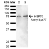 Rabbit Anti-HSP70 Antibody (Acetyl Lys77) used in Western blot (WB) on Cervical cancer cell line (HeLa) lysate (SPC-743)