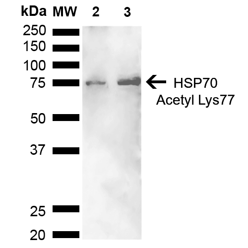 Anti Hsp70 Antibody Acetyl Lys77 Polyclonal Stressmarq Biosciences Inc