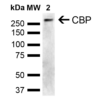 Rabbit Anti-CBP Antibody used in Western blot (WB) on Cervical cancer cell line (HeLa) lysate (SPC-752)