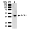Rabbit Anti-ROR1 Antibody used in Western blot (WB) on Kidney (SPC-762)