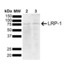 Rabbit Anti-LRP1 Antibody used in Western blot (WB) on Brain (SPC-785)
