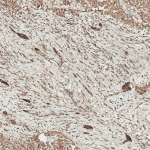 SPC-785_LRP1_Antibody_IHC_Human_Liver_10X_1.png