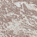 SPC-786_SFRP2_Antibody_IHC_Human_Liver_20X_1.png