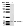 Rabbit Anti-SFRP2 Antibody used in Western blot (WB) on Brain (SPC-786)