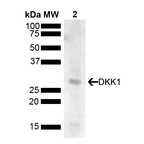 DKK1 Antibody: RPE | Scientist.com