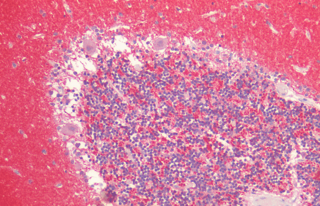 <p>Immunohistochemistry analysis using Rabbit Anti-Alpha Synuclein Polyclonal Antibody (SPC-800). Tissue: Cerebellum. Species: Human. Fixation: Formalin fixed paraffin-embedded. Primary Antibody: Rabbit Anti-Alpha Synuclein Polyclonal Antibody (SPC-800).</p>
