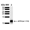 Rabbit Anti-Alpha Synuclein Antibody used in Western blot (WB) on Truncated Alpha Synuclein Protein (SPC-800)