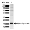 Rabbit Anti-Alpha Synuclein Antibody   used in Western blot (WB) on Brain (SPC-800)