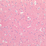 SPC-802_Tau_Antibody_IHC_Human_Brain-Cortex_1.png