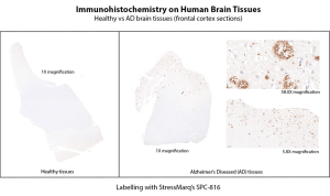 Rabbit Anti-Amyloid Beta Aggregate Antibody used in Immunohistochemistry (IHC) on Human Brain (SPC-816)