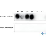 SPC-986_G6PD-pTyr401_Antibody_SPOT_1.png