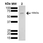 SPR-104_HSP60_Protein_SDS-Page.png