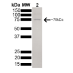 SPR-106_HSC70_Protein_SDS-Page.png