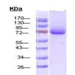 SPR-115_HSP70_Protein_SDS-Page.png