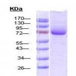 SPR-117_HSP70_Protein_SDS-Page.png