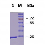 SPR-118_HSP27_Protein_SDS-Page.png