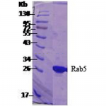 SPR-121_RAB5_Protein_SDS-Page.png