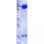 SPR-302_HOP_Protein_SDS-Page.png