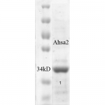 SPR-312_AHA2_Protein_SDS-Page.png