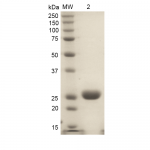 SPR-315_HO-1-Protein-SDS-Page-1.png