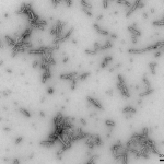 SPR-317_Alpha-Synuclein-Preformed-Fibrils-Protein-TEM-4.png