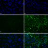 Primary rat hippocampal neurons show lewy body inclusion formation when treated with Type 1 Alpha Synuclein Protein Pre-formed Fibrils (SPR-322) (D-F), but not when treated with Type 2 Alpha Synuclein Protein Pre-formed Fibrils (SPR-317) (A-C).