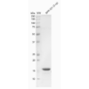 SDS-Page of huma alpha synuclein monomer (SPR-321)