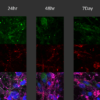 Human iPSC-derived neurons seeded with ATTO594 labelled alpha synuclein PFFs (SPR-322-A594)